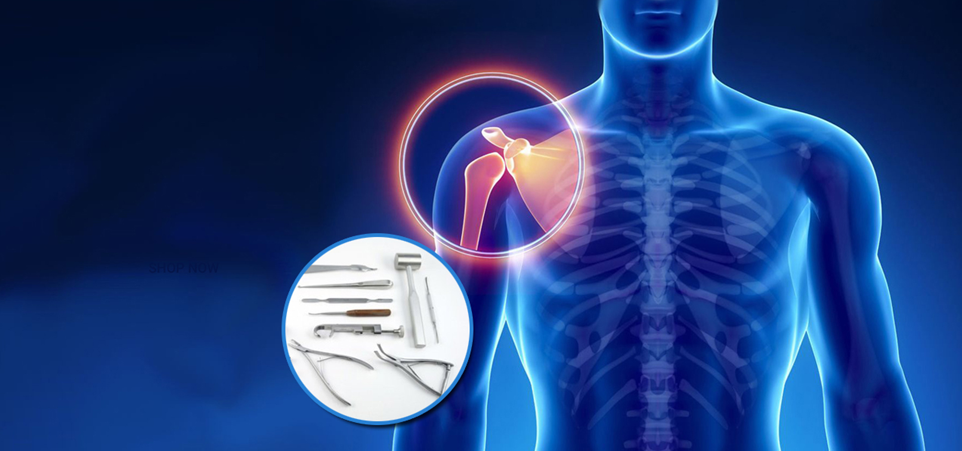 Orthopedic banner surgicost